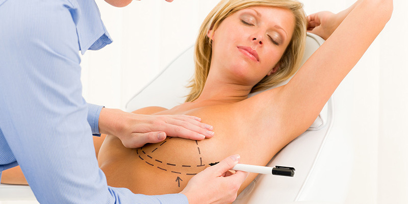 Plastic surgery doctor draw line patient breast